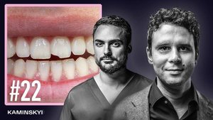 Как отличить хорошего стоматолога от плохого? Виниры – сложности и ошибки
