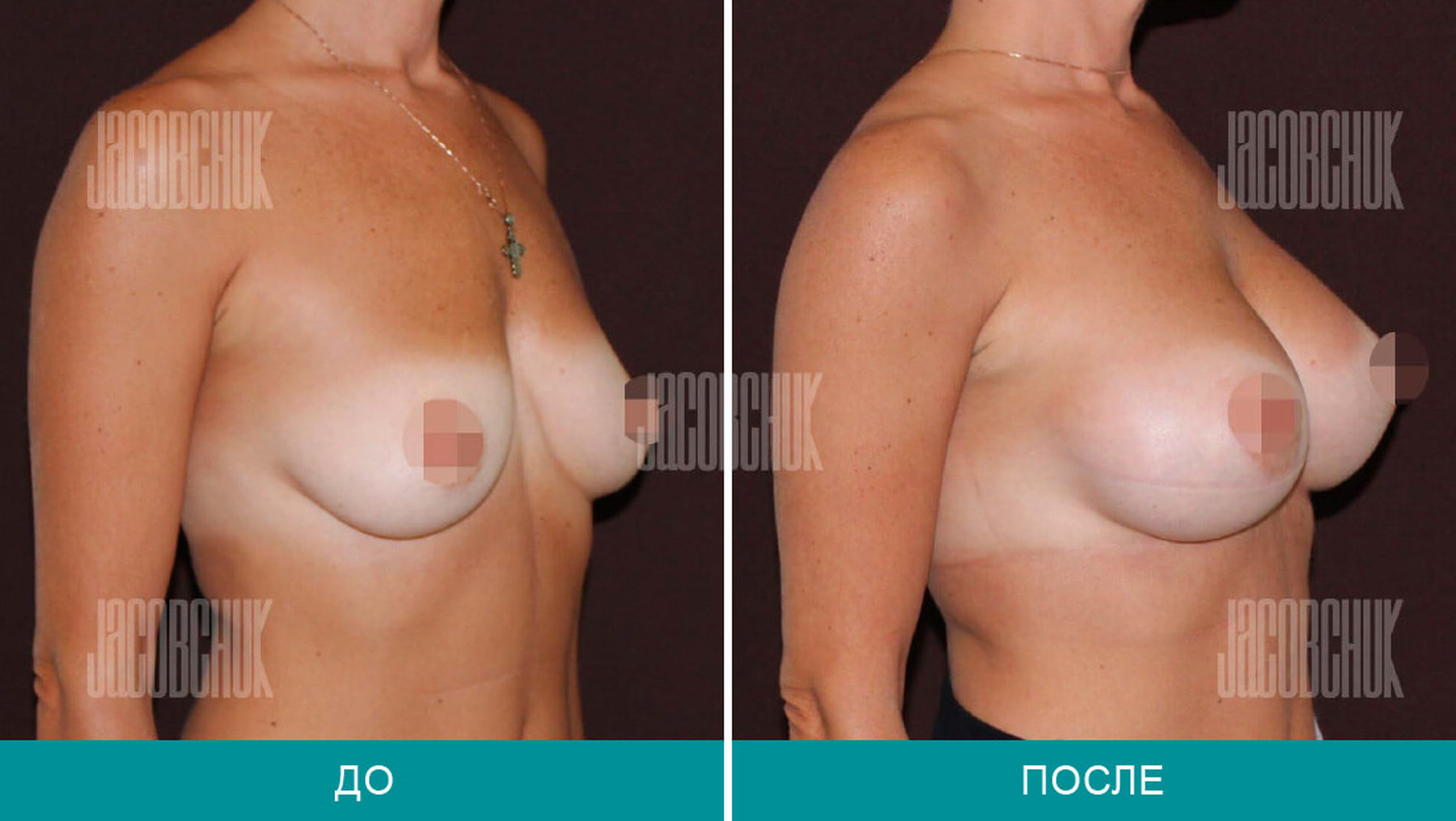 на сколько размеров может увеличиться грудь во время беременности фото 112
