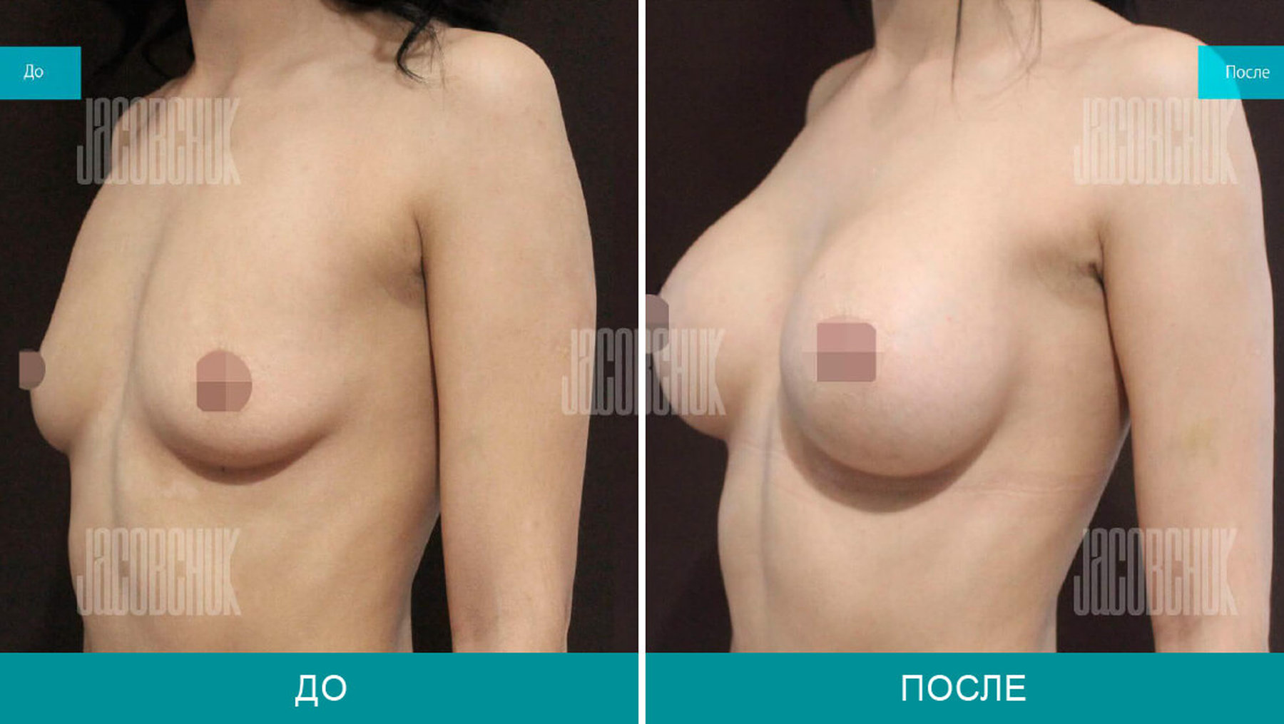 что отвечает за рост груди у женщин фото 112